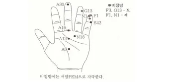 두통 수지침 편두통 혈자리_23
