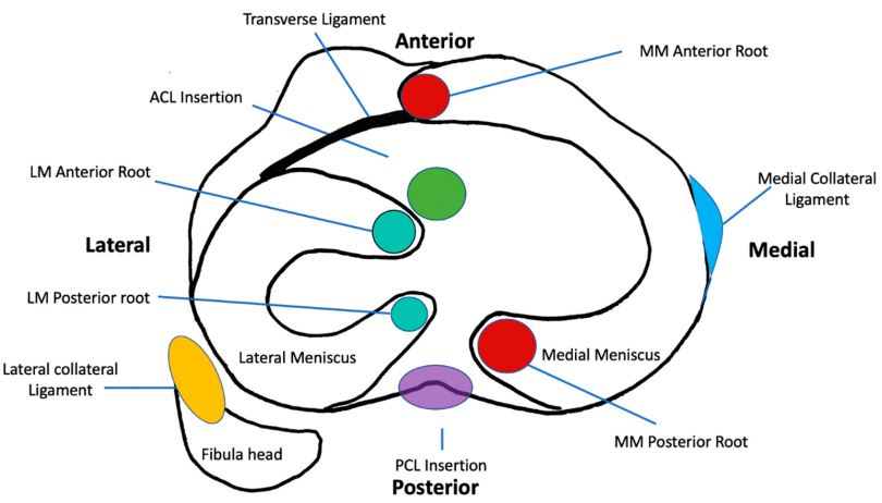 무릎 관절 내에 있는 반월판연골의 부착부가 나와 있는 해부학 그림