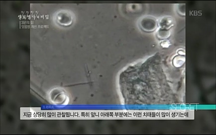 [670회] 생로병사의 비밀 - KBS670회] 생로병사의 비밀.ts_20220505_143156.529.jpg