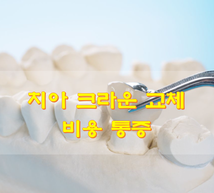  치아 크라운 교체 비용 통증