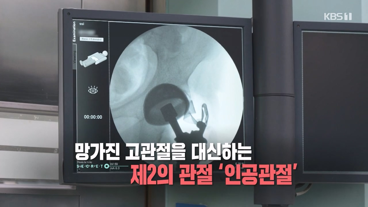 생로병사의 비밀.E890.231116p-NEXT.mp4_20231116_202652.923.jpg