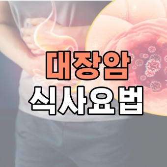 대장암 진료 및 치료 초기증상 생존률