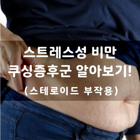 남성이 살이 튼 뱃살을 잡고 있다. 그 위에 텍스트로 스트레스성 비만 쿠싱증후군 알아보기! (스테로이드 부작용) 이라고 쓰여져 있다