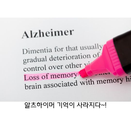  알츠하이머 정의와 원인 치료방법과 예방법