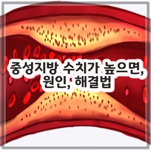 중성지방 수치가 높으면&#44; 원인&#44; 해결법