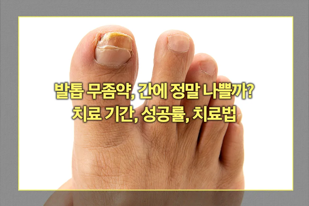발톱 무좀 치료 기간, 성공률, 치료법