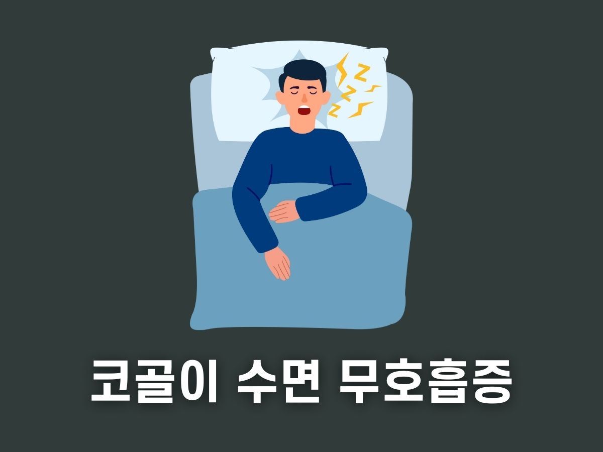 수면 무호흡증 치료병원&#44; 코골이 수술비용