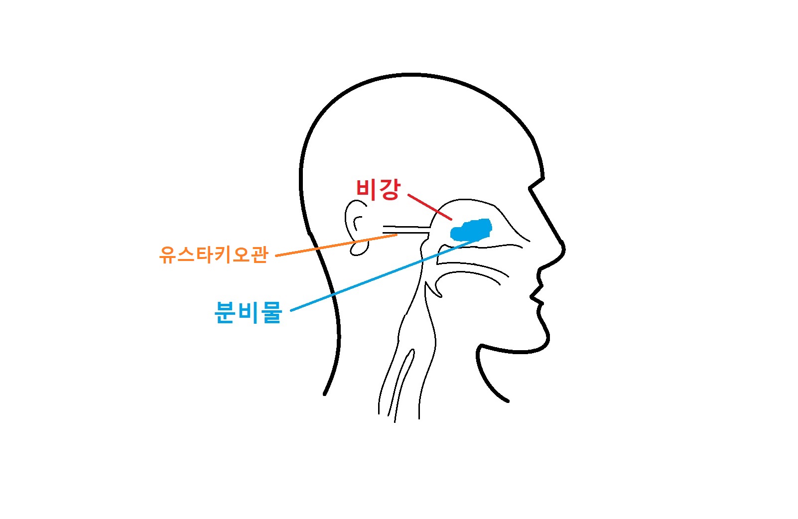 비강-유스타키오관