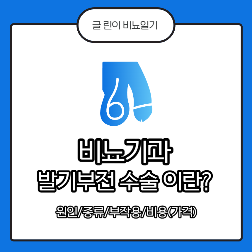  비뇨기과 발기부전 수술 이란? 원인/종류/부작용/비용(가격)