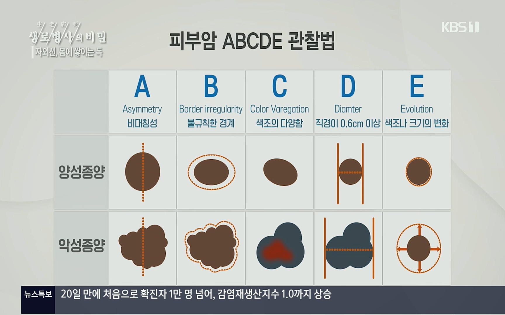 생로병사의 비밀.E824.220629p.H264-F1RST.mp4_20220630_204342.973.jpg