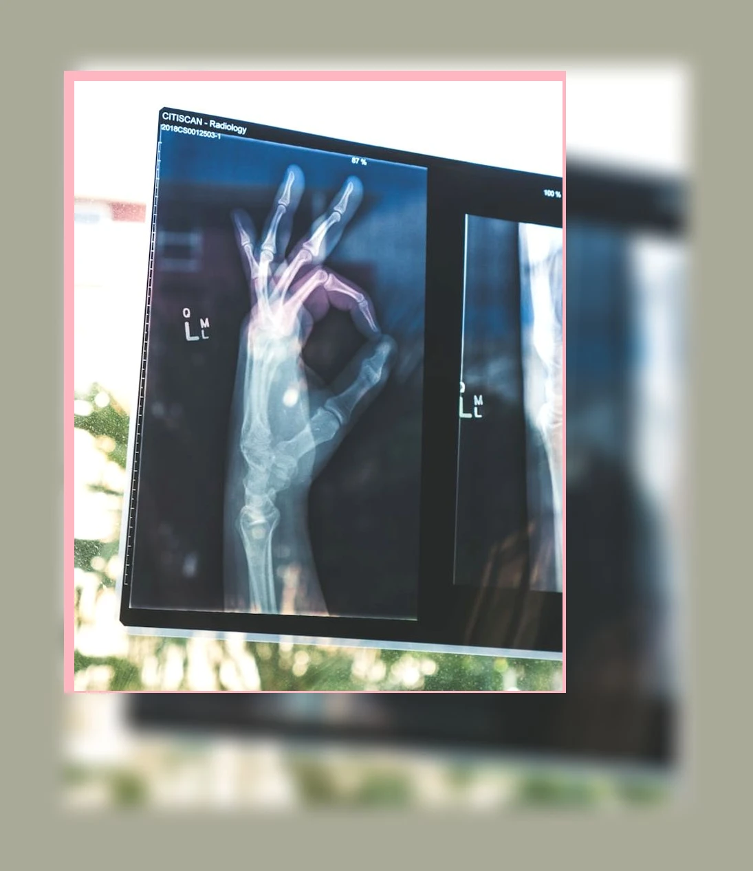 레몬의 건강 효능_2_subsection