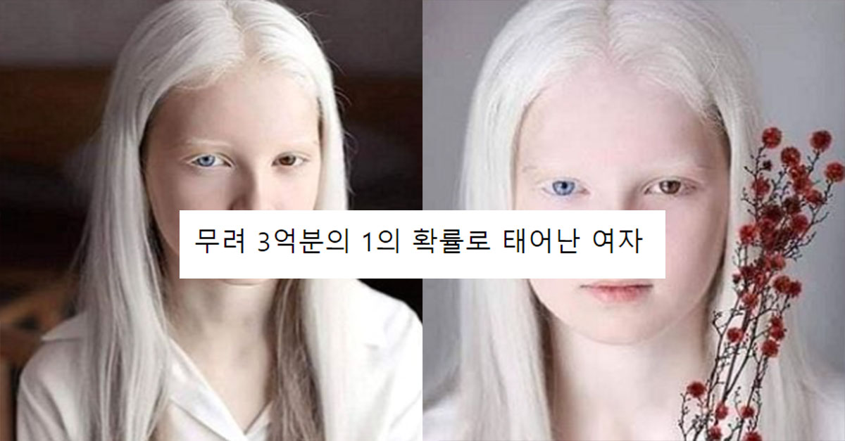  3억 분의 1확률로 태어났다는 여성의 외모