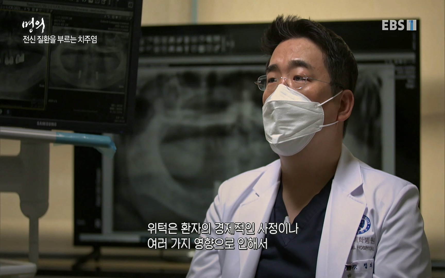 EBS 명의 헬스케어 - TV - 교육의 중심 EBS치주염이 코로나로 소홀해진 구강관리가 치아를 더 망가트리고 위험하게 만들며, 증상이 없기 때문에 특히 더 조심하고 치은염 단계에서 진행되지 않도록 예방해야한다 정의원 교수님과 치_20220505_151718.397.jpg