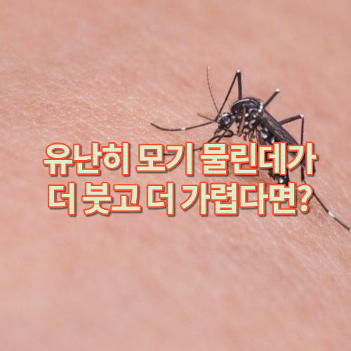  유난히 모기 물린데가 더 붓고 더 가렵다면?