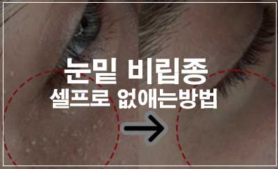 피부 탔을때 껍질