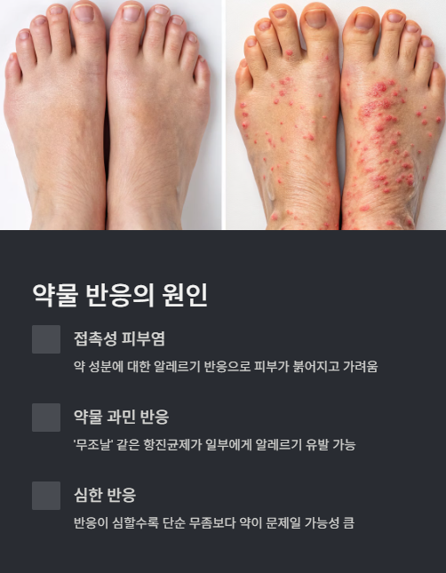 약물 반응의 원인