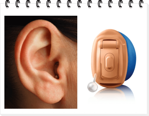 초소형 보청기 착용 사진