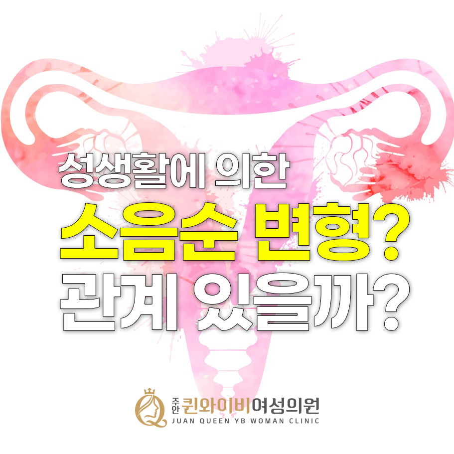 주안역산부인과, 성관계에 의한 소음순 변형? 관계 있을까?