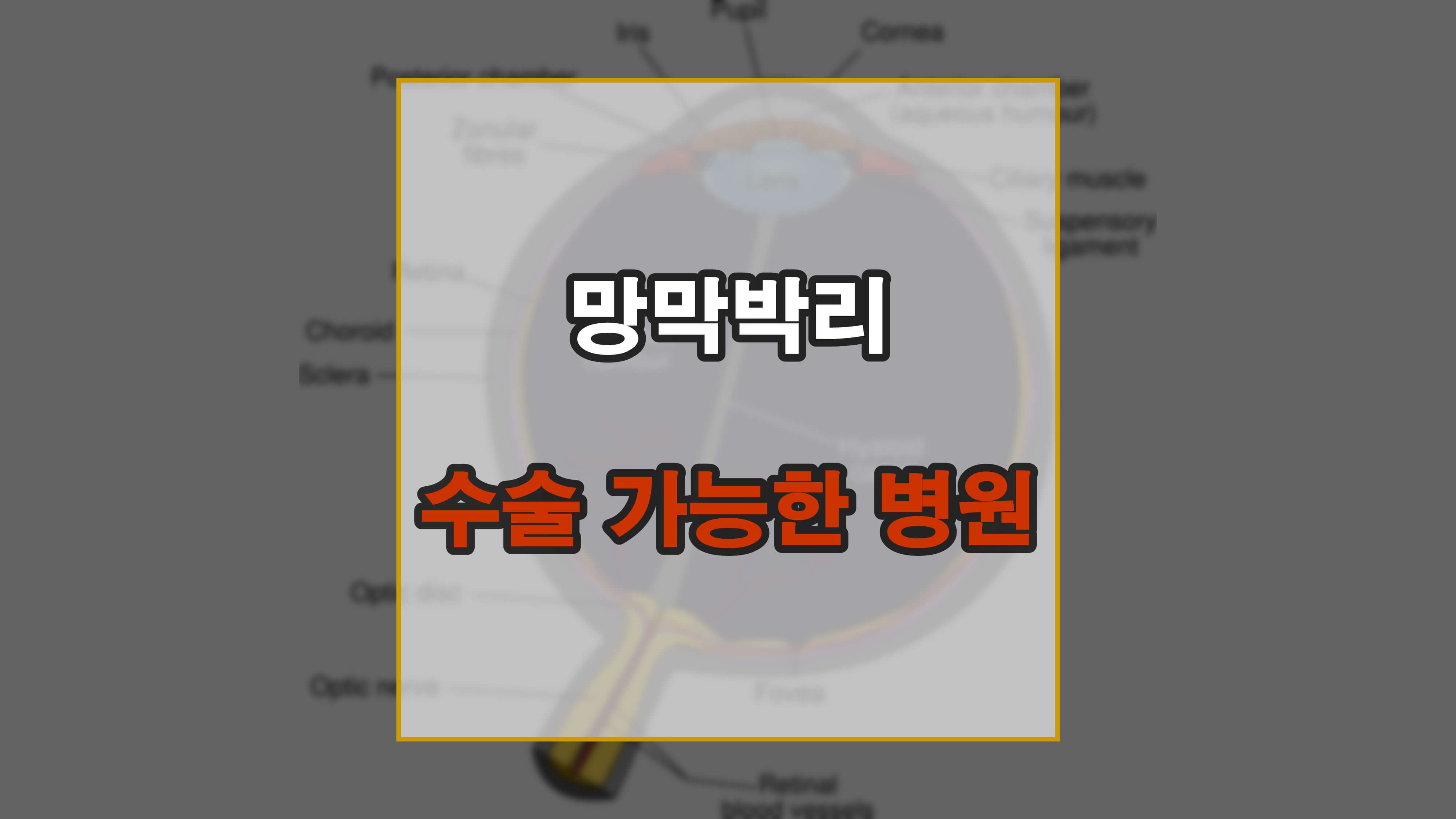 망막박리 수술 가능 병원