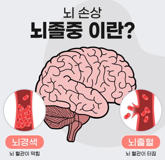 뇌그림이 그려져있고 좌측에는 뇌경색, 우측에는 뇌출혈 그림이 같이 그려져있다