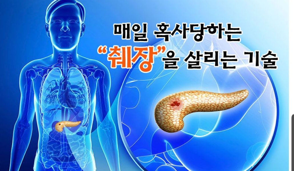  매일 혹사당하는 "췌장"을 살리는 기술