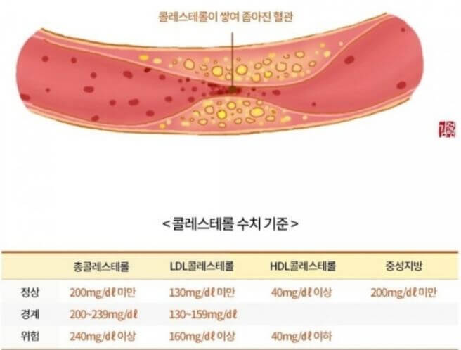 혈관청소에 좋은 음식