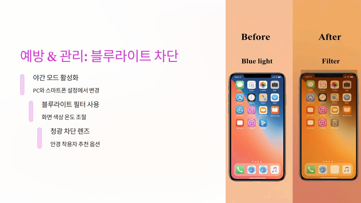 VDT 증후군 증상