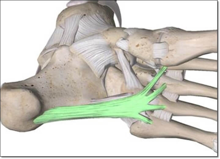 발바닥 장족저인대를 보여주는 그림
