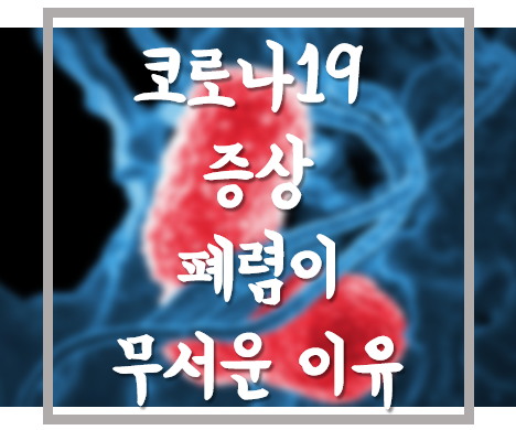  [생활의지혜] 코로나19 대표 증상, 폐렴이 무서운 이유, '감기','독감'과 차이점!
