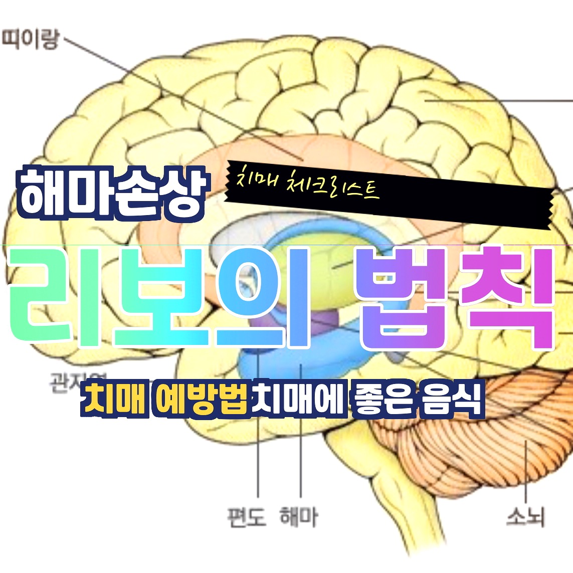  해마 손상 리보의 법칙에서 치매 체크리스트 예방법 좋은음식까지 총정리