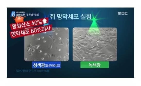 비문증약 비문증영양제