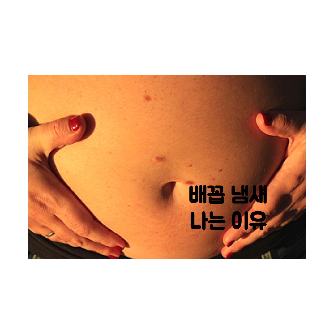 배꼽 냄새가 나는 이유와 해결 방법