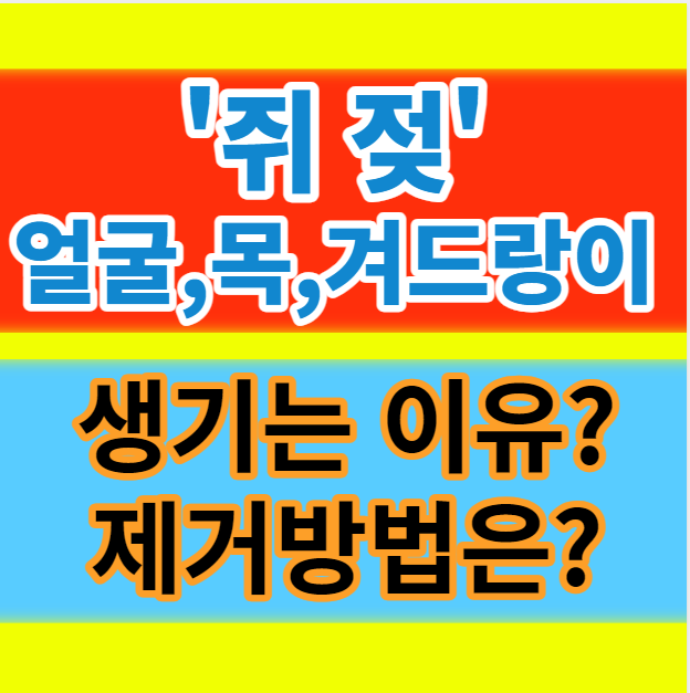  겨드랑이 쥐젖 비립종 원인과 제거크림 연고 비용은 얼마나 될까?