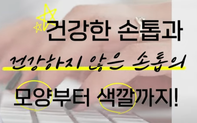  손톱으로 보는 건강상태 정확한 정보 확인하세요