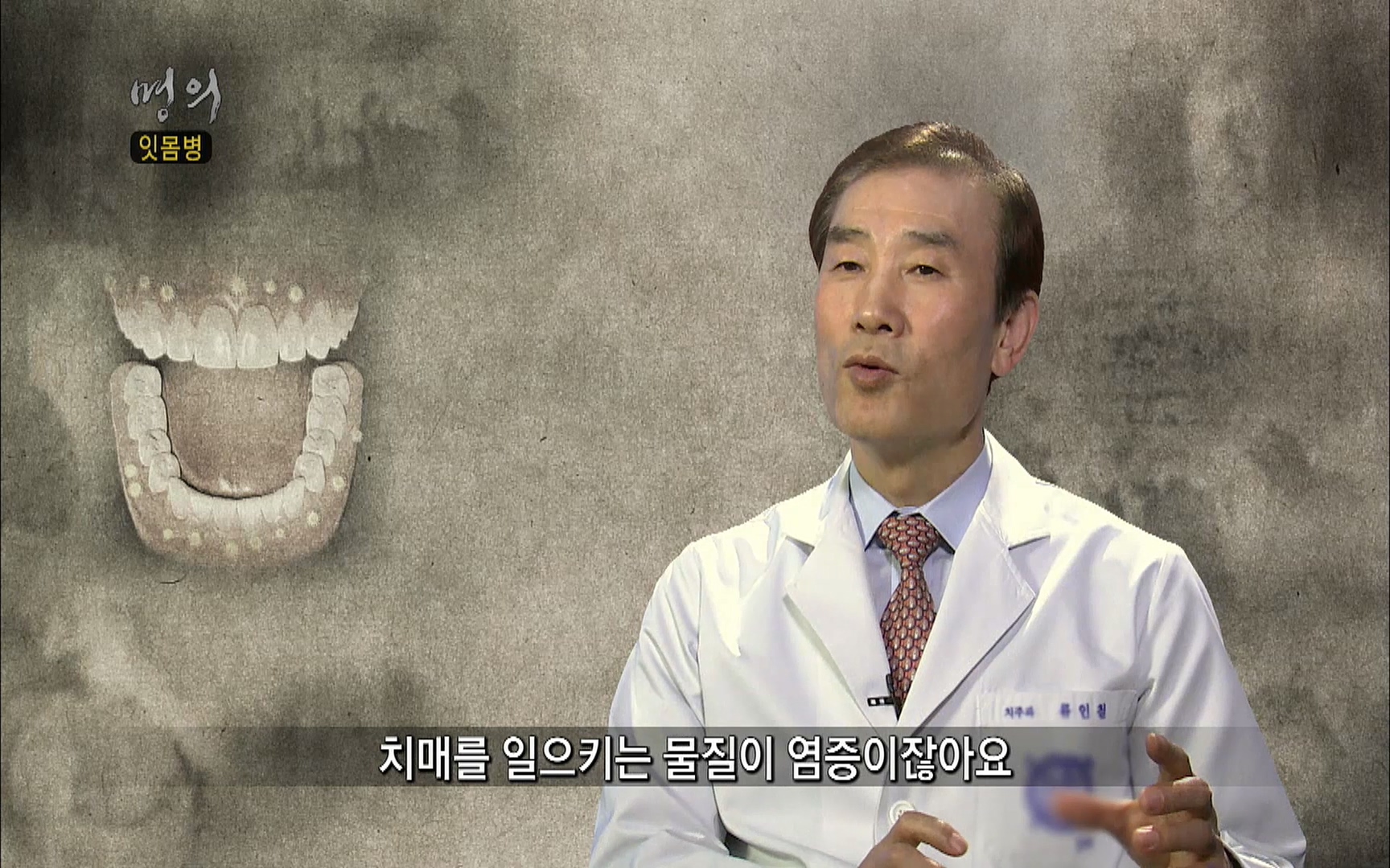 EBS 명의 헬스케어 - TV - 교육의 중심 EBS2015년 1월 16일 (금) 밤 9시 50분, EBS1.mp4_20220505_150403.525.jpg