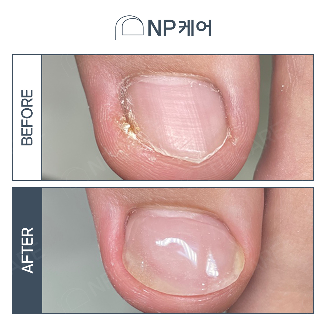 베스트네일 이미지