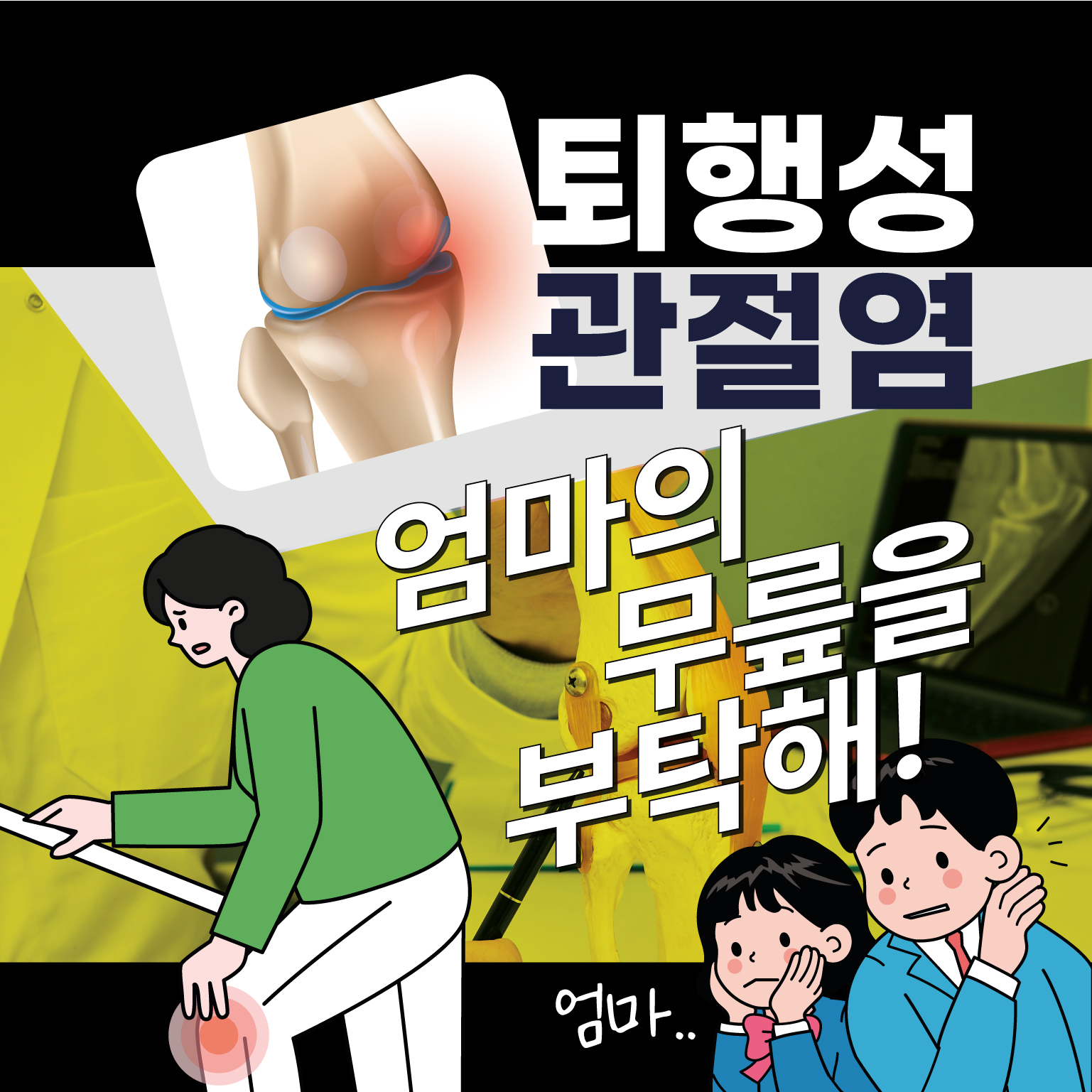  석촌역재활의학과, 무릎 퇴행성관절염 인공관절 수술만이 답이다?