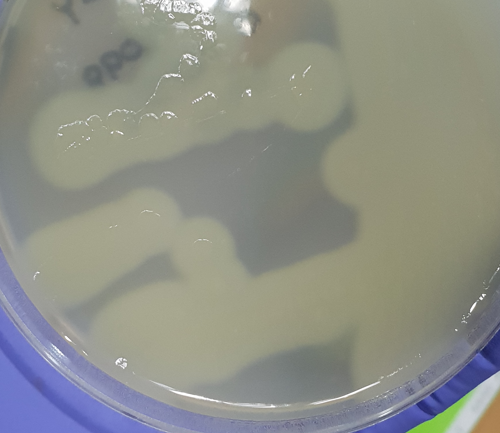  [식품공전] 클로스트리디움 퍼프린젠스 미생물시험법 (Clostridium perfringens)