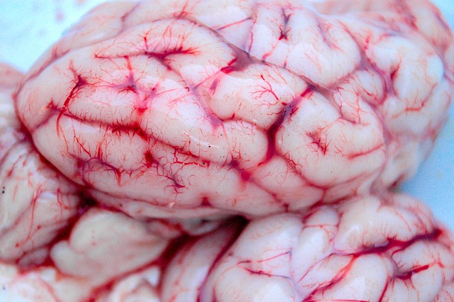 뇌종양생존율