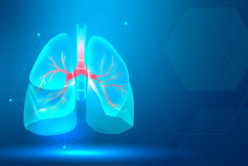 폐렴은 어떤 병이고 왜 생기나요?
