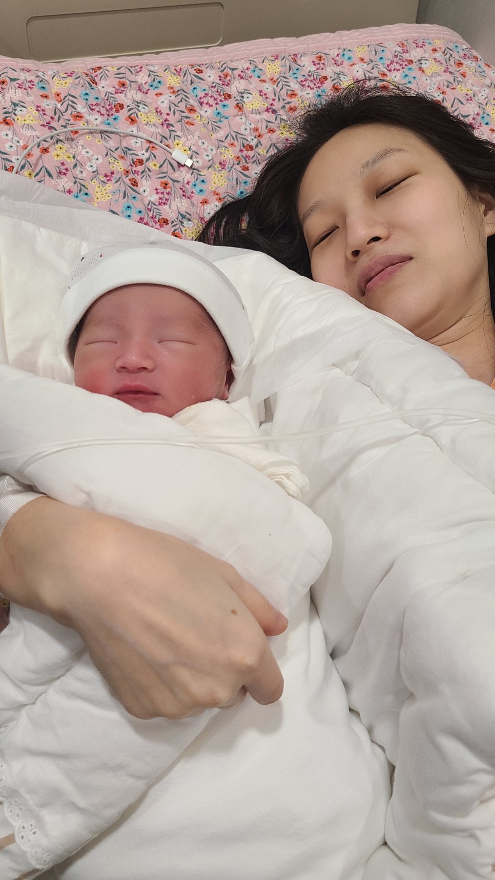 제왕절개 1일차 _ 제왕절개는 이런 3