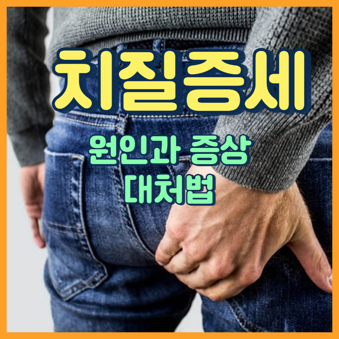  치질 증세, 원인과 증상 대처법