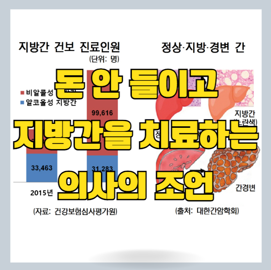  의사가 알려주는 돈 안 들이고 지방간 없애는 방법과 간에 좋은 치료 음식 및 영양제 추천