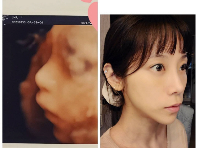  '예비맘' 조민아, 똑닮은 초음파 사진 공개..."딱 제 아들 같죠"