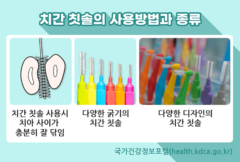 치간 칫솔의 사용방법과 종류