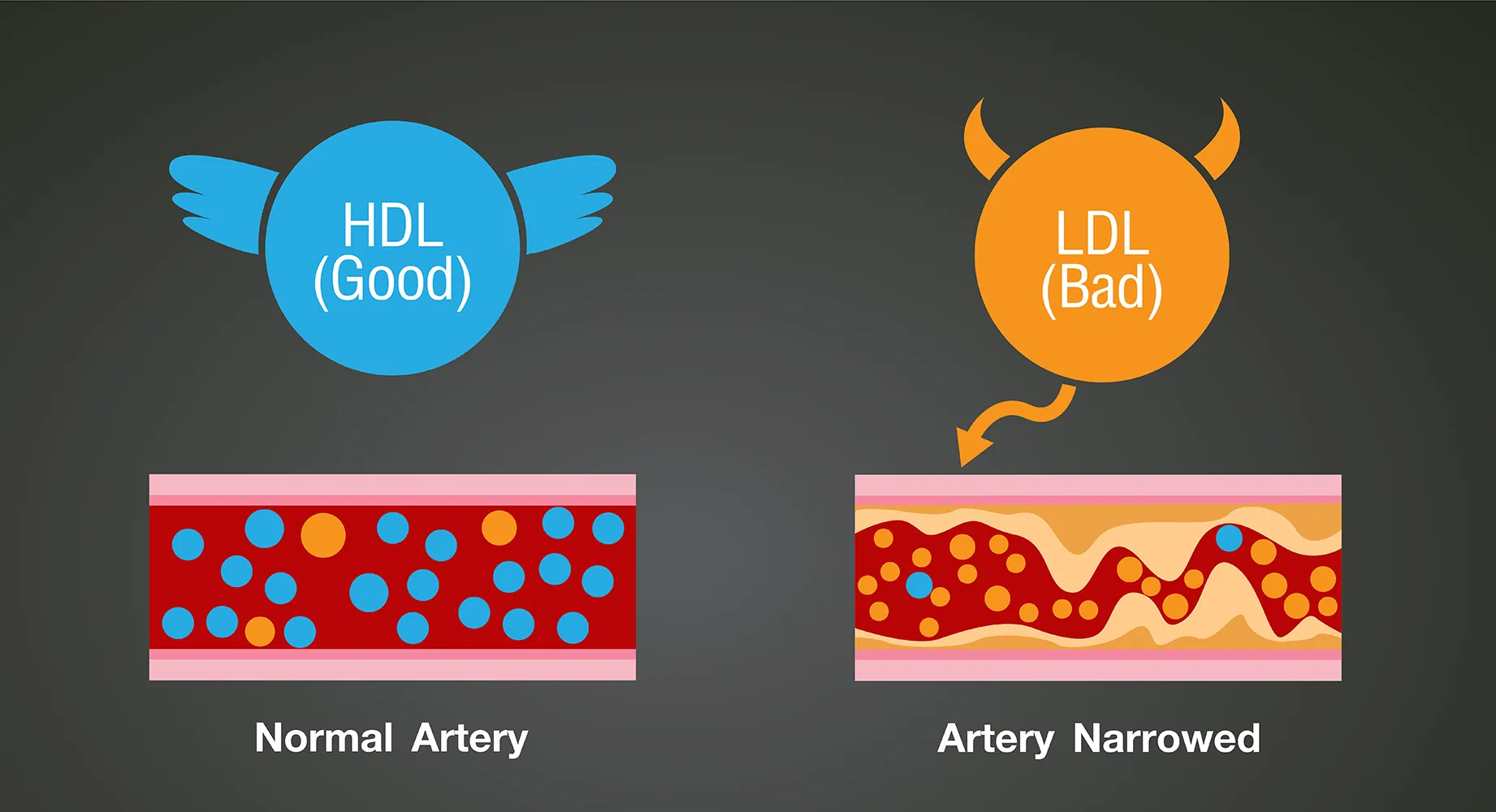 LDL과 HDL의 혈관 차이를 나타낸 그래픽이미지