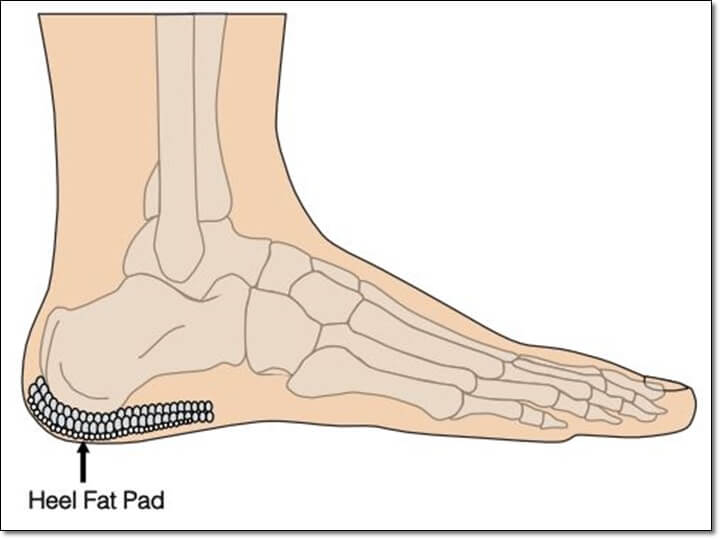 발 뒤꿈치의 지방 패드의 배열을 잘 보여주는 그림