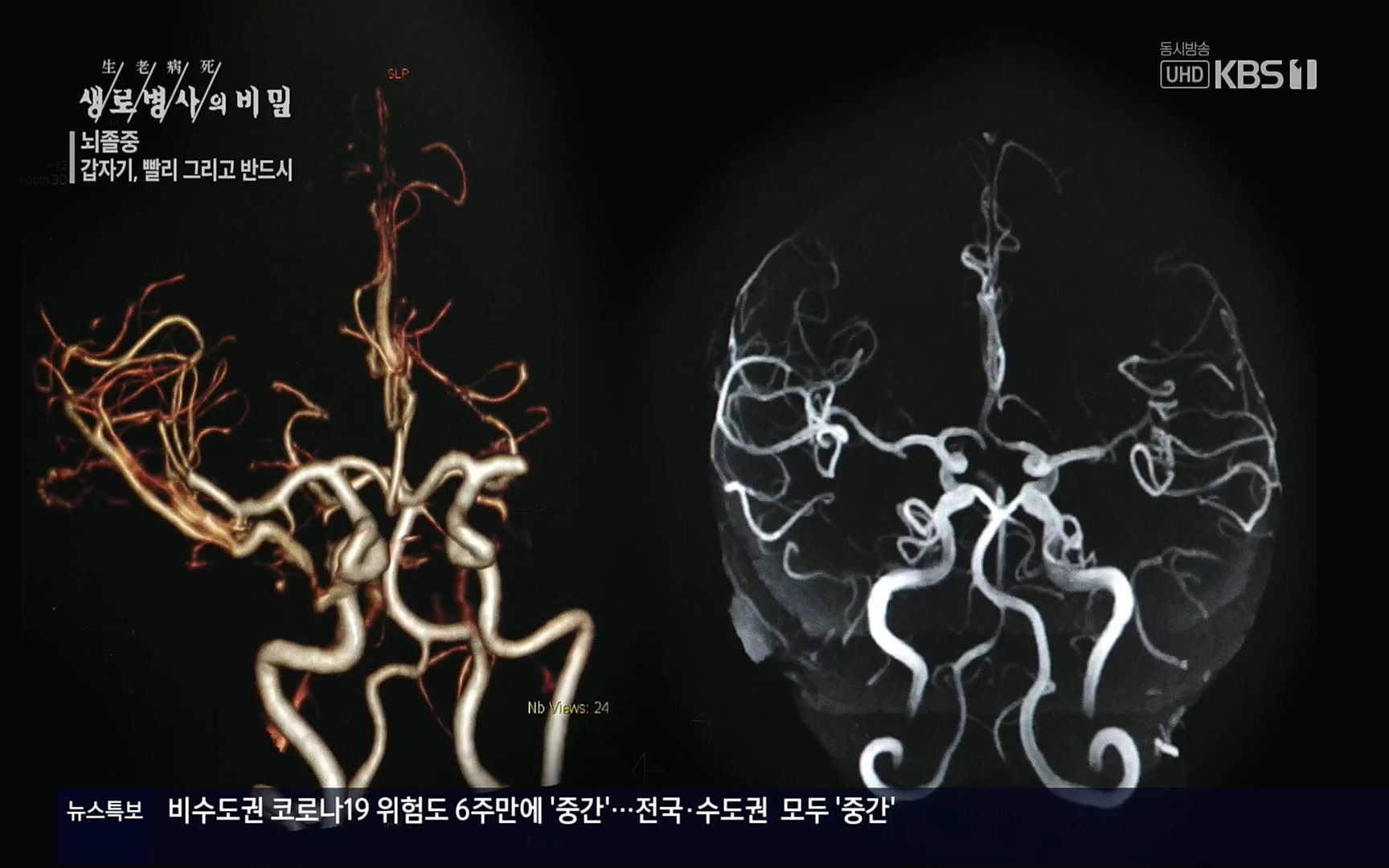 생로병사의 비밀.E835p.H264-F1RST.mp4_20220917_181738.450.jpg