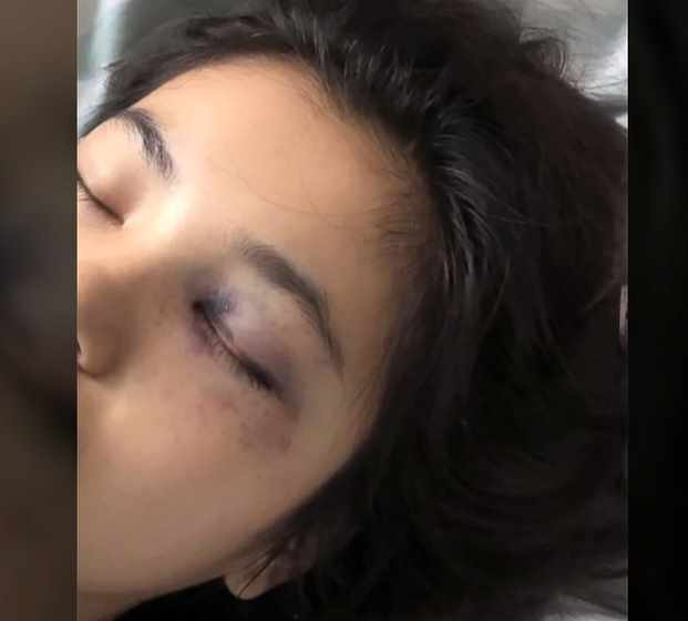 전남편이 휘발유를 붓고 불붙여 숨진 중국 인터넷 스타 라무 전남편이 휘발유를 붓고 불붙여 숨진 중국 인터넷 스타 라무