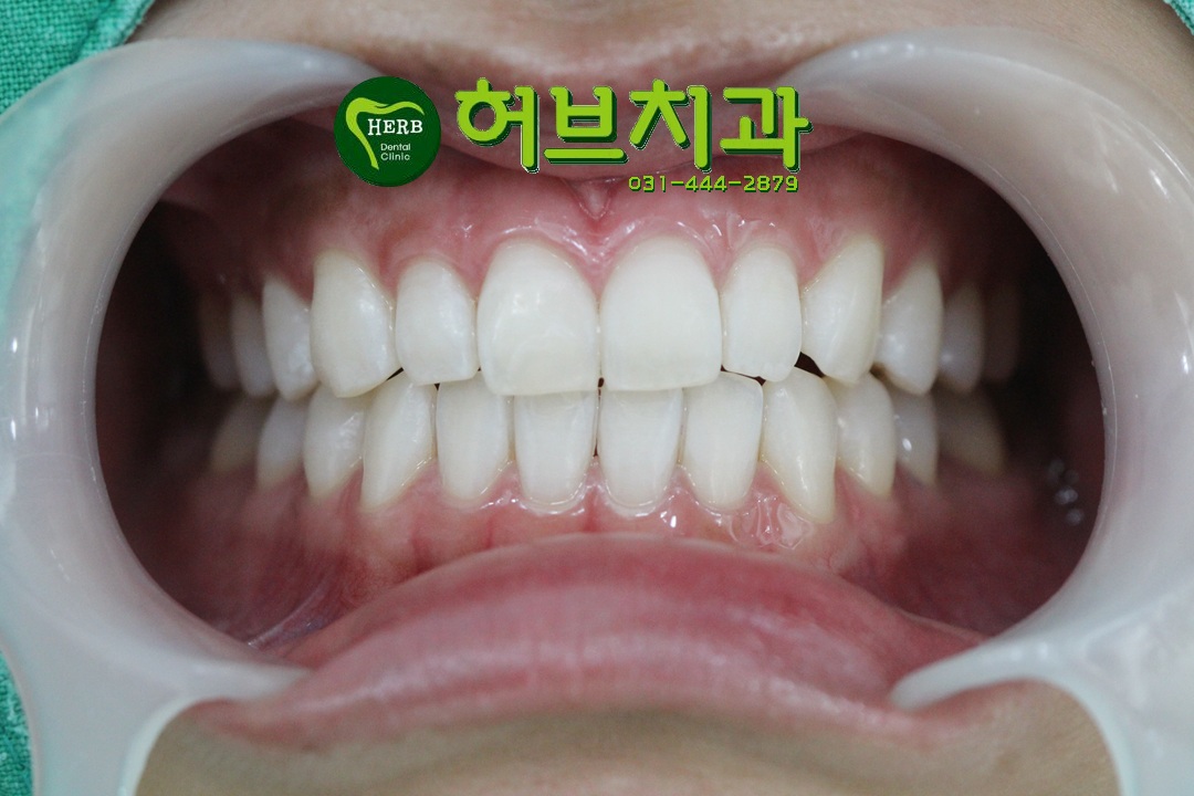 허브치과 이미지